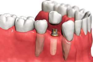 Ортопедическая стоматология 